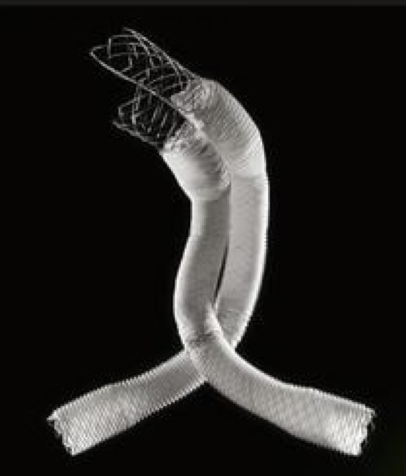 Endovascular Aneurysm Repair (EVAR) Market