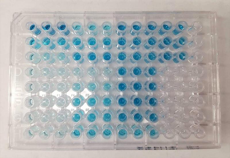 Enzyme Linked Immunosorbent Assay