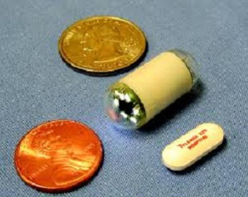 Esophageal Video Capsule Endoscopy