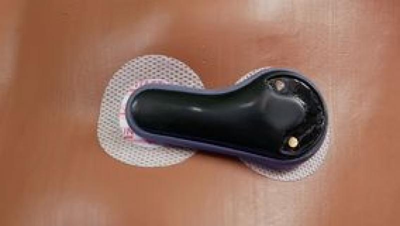 External Pacemakers Industry