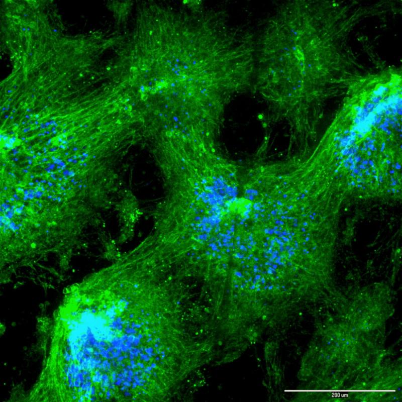 Extracellular Matrix