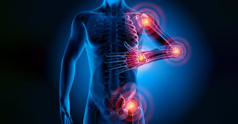 Fibromyalgia Treatment Market