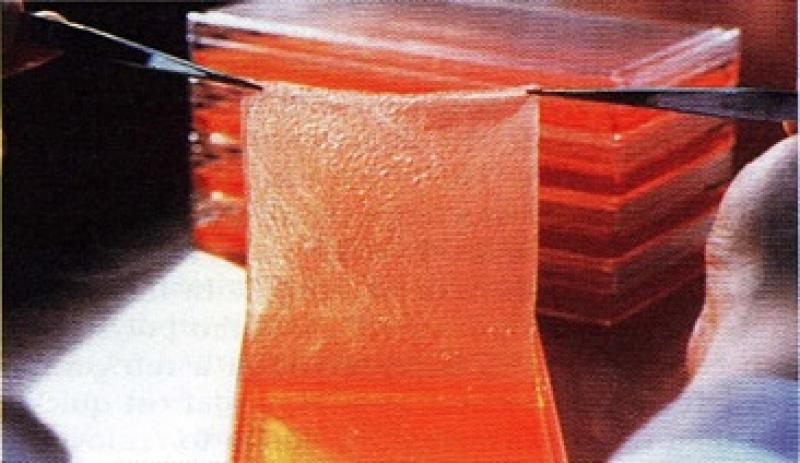 Collagen Biomaterial Market