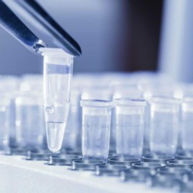 Global Digital PCR (dPCR) and qPCR Market Global Digital PCR (dPCR) and qPCR Market