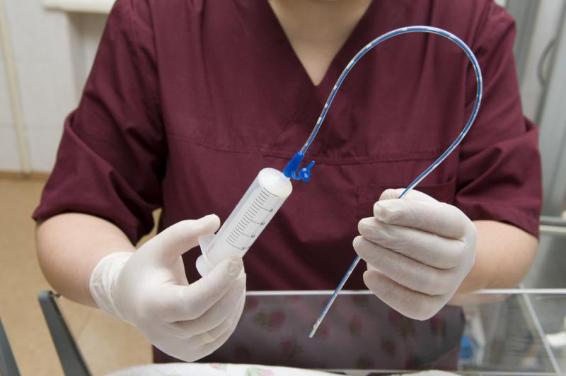 Global Feeding Tubes Market