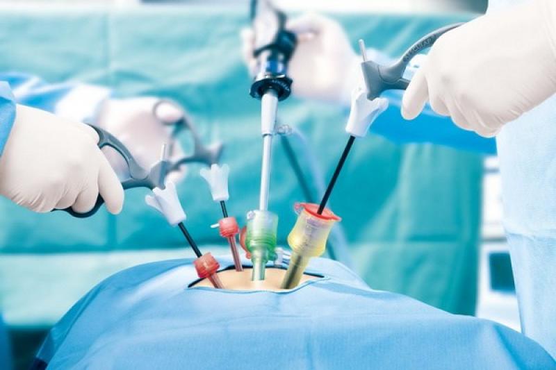 Global Laparoscopy Devices Market 2025