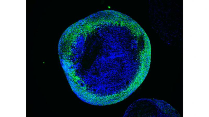 Leigh Syndrome Treatment Market