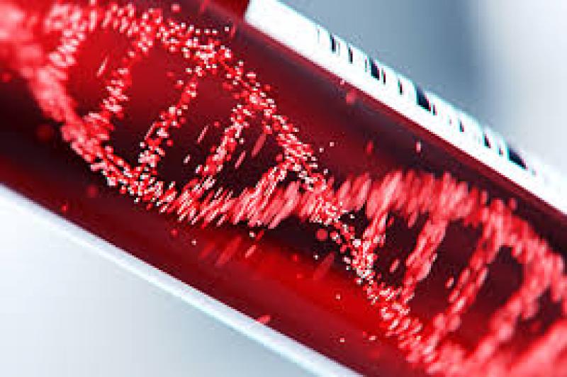 Global Lentiviral Expression Systems Market Global Lentiviral Expression Systems Market