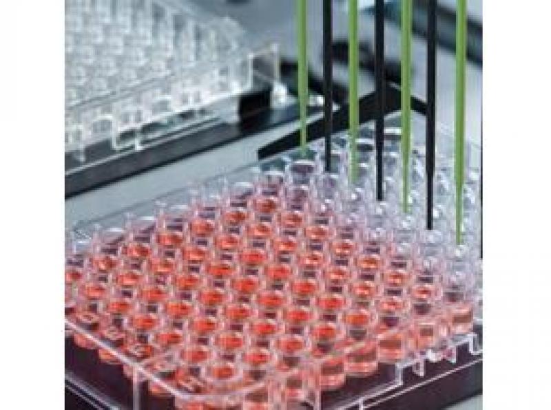 Global Scaffold Free 3D Cell Culture Plate Sales Market Report 2017 Global Scaffold Free 3D Cell Culture Plate Sales Market Report 2017