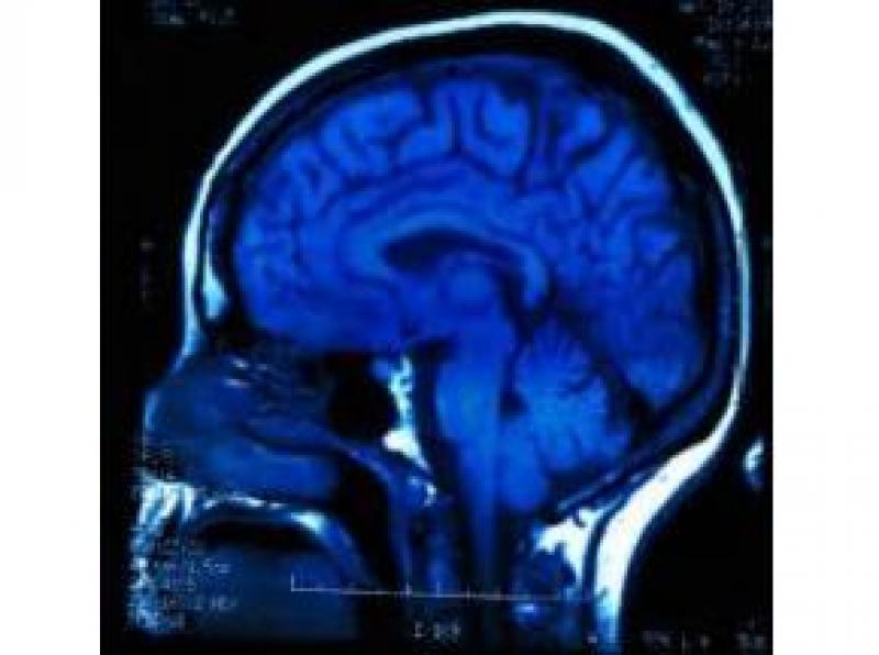 Global X-Ray Contrast Agents Sales Market Report 2017 Global X-Ray Contrast Agents Sales Market Report 2017