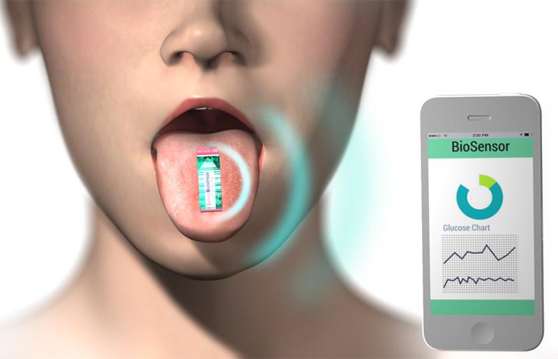 Glucose Biosensor, Glucose Biosensor Market, Glucose Biosensor Market Growth