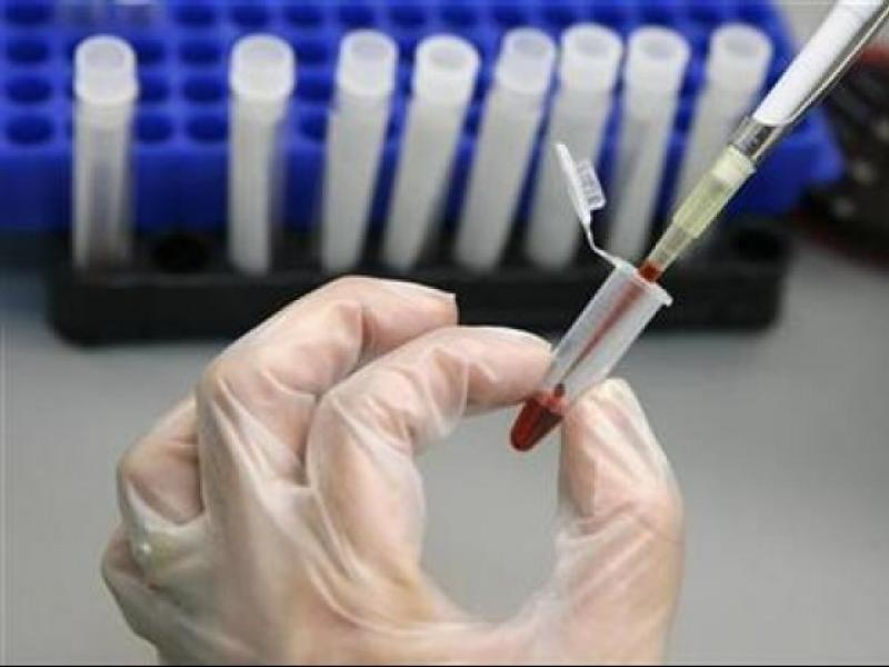 HIV/AIDS Diagnostics