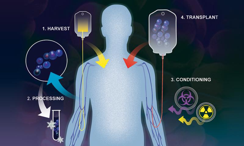 Hematopoietic Stem Cell Transplantation (HSCT) Market