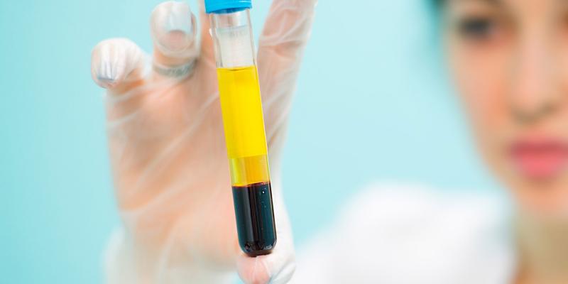Human Platelet Lysate Market