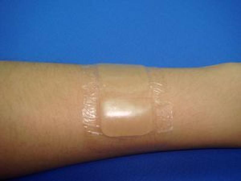 Global Hydrogel Dressing Market Research Report 2017-2022