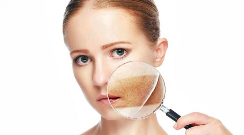 Hyperpigmentation Disorders Treatment Market