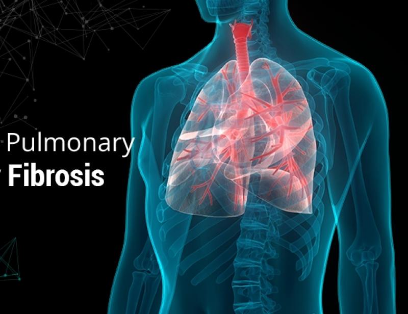 Idiopathic Pulmonary Fibrosis (IPF) Treatment Market 