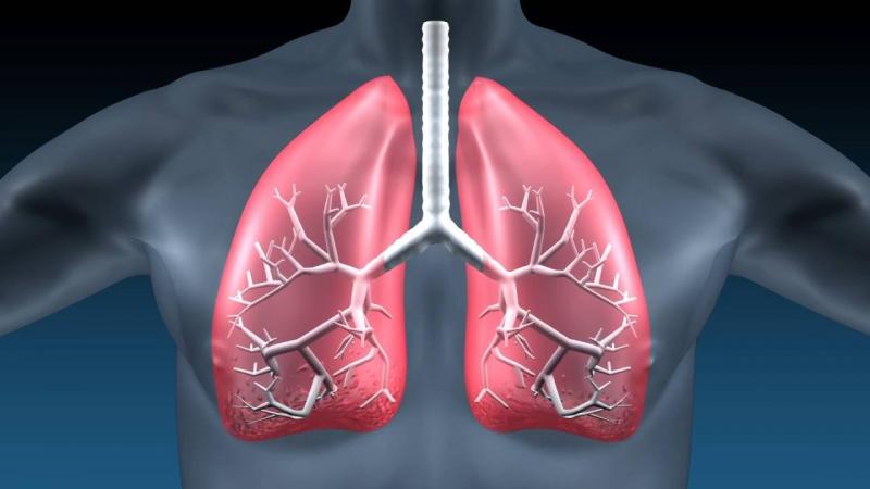 Idiopathic Pulmonary Fibrosis Market Idiopathic Pulmonary Fibrosis Market