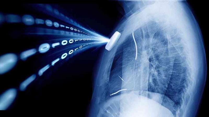 Implantable Medical Devices, Implantable Medical Devices Market, Implantable Medical Devices Market Growth,  	implantable medical devices companies, implantable medical devices definition