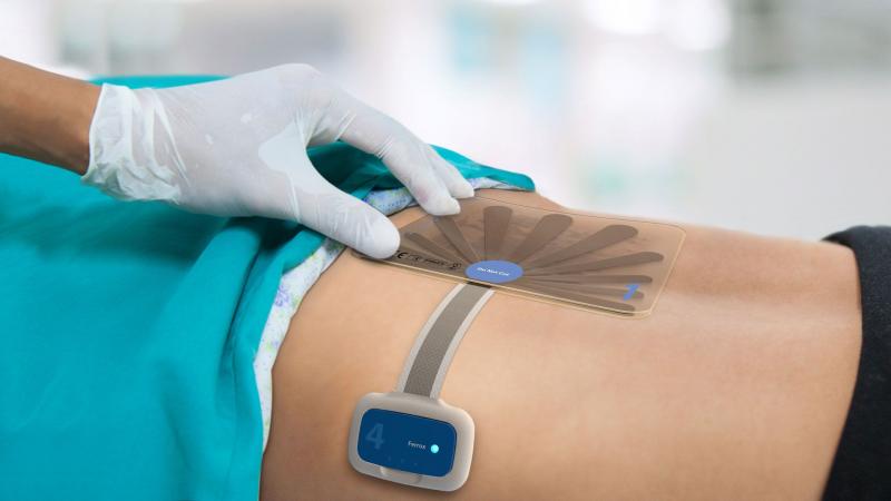 India Advanced Wound Care Management market 