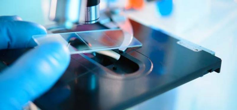 Infectious Disease Diagnostics