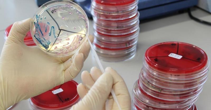 Infectious Disease Diagnostics