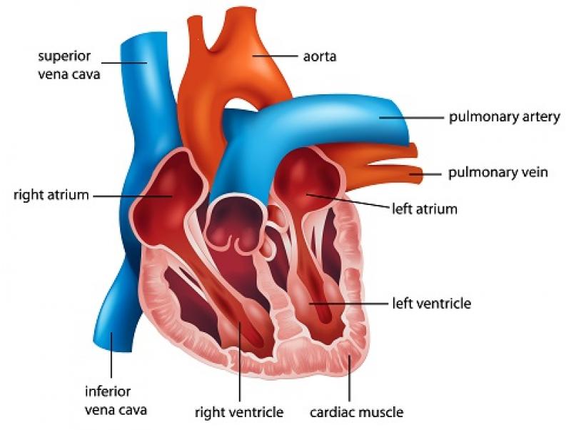 Inferior Vena Cava (IVC) Filters