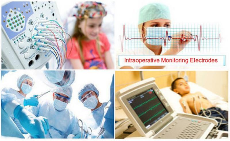 Intraoperative Monitoring Electrodes Market