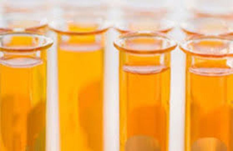 Asia-Pacific Isopropyl Esters Market Report 2018 Isopropyl Esters