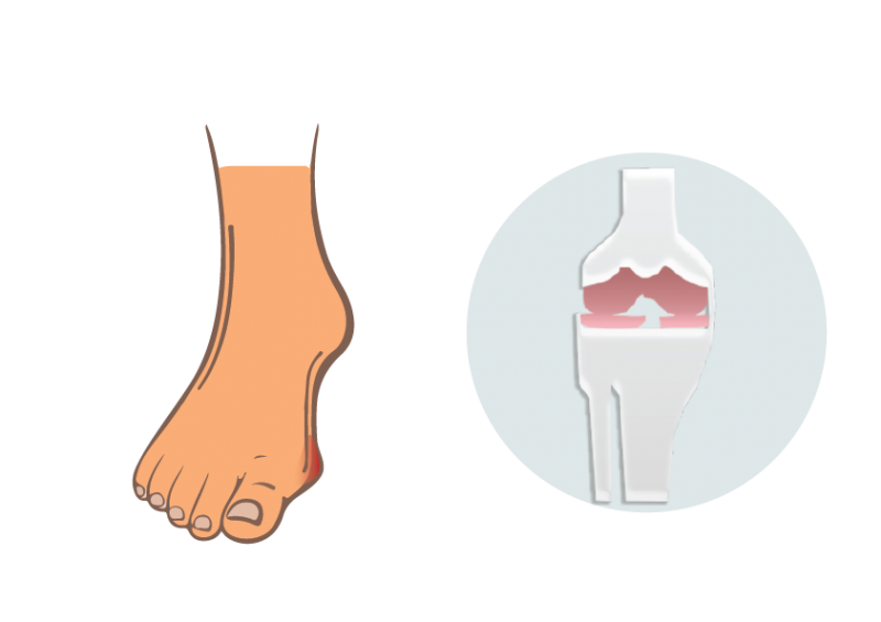 best ayurvedic medicine for arthritis in nagpur