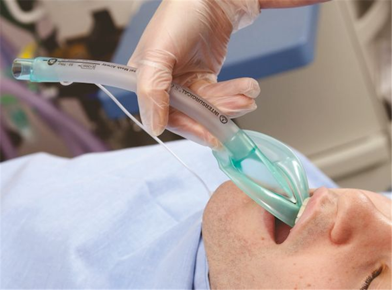 Laryngeal Mask Market