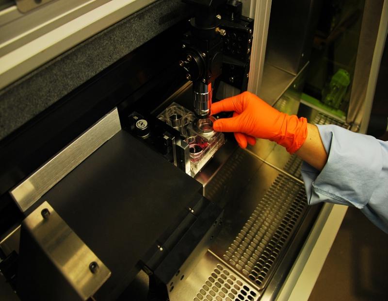 Laser-based 3D Bioprinting, Laser-based 3D Bioprinting Market, Laser-based 3D Bioprinting Market Growth