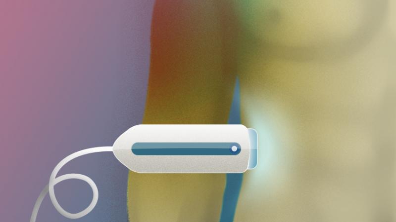 Liver Biopsy System