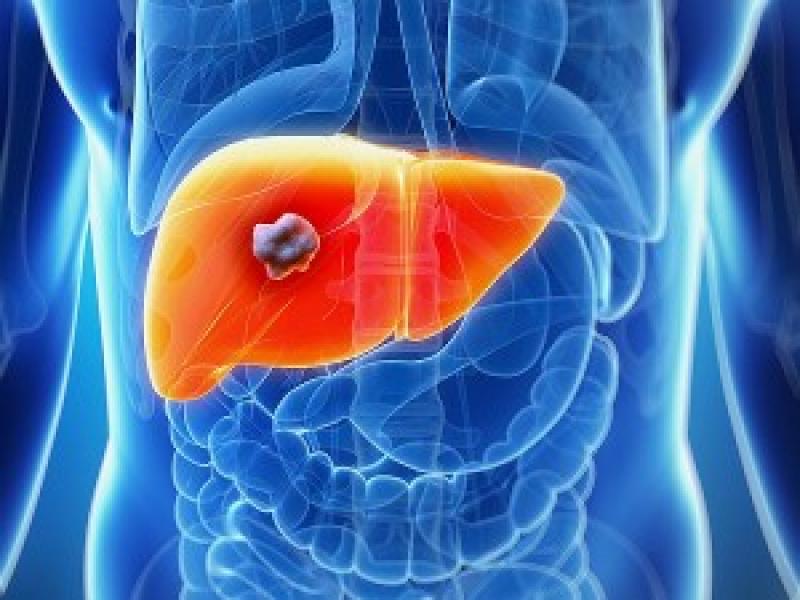 Global Liver Cancer Therapeutics Market
