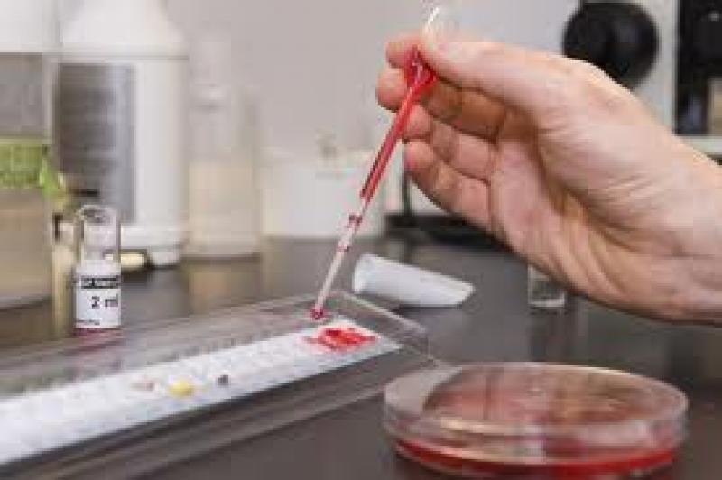 Lyme Disease Diagnostics