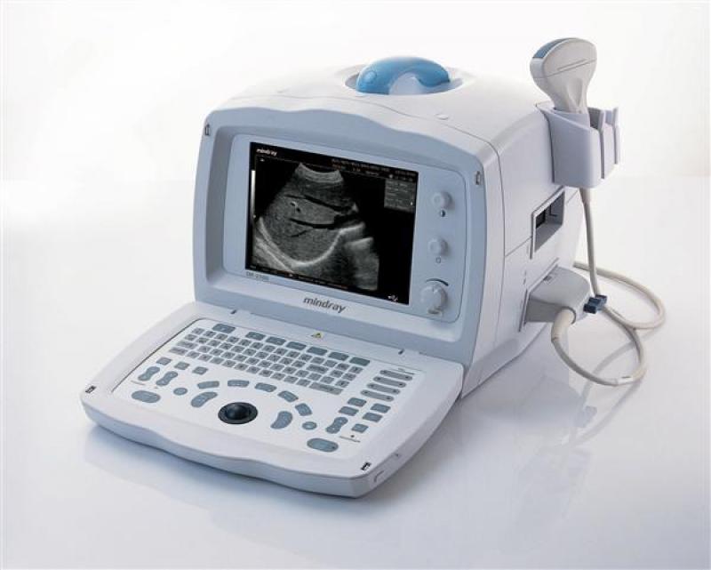 Medical Diagnostic Ultrasound Device