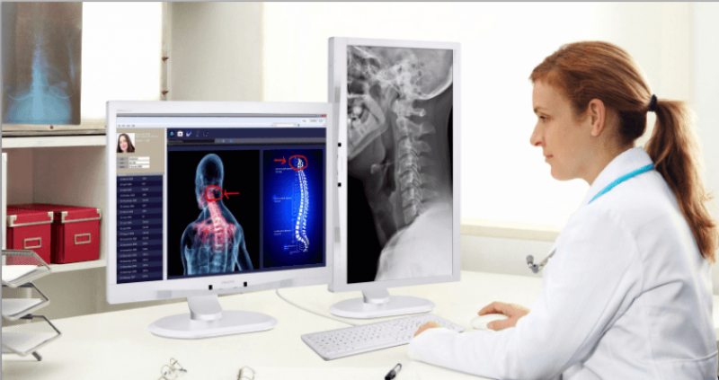 Medical Imaging Displays Market