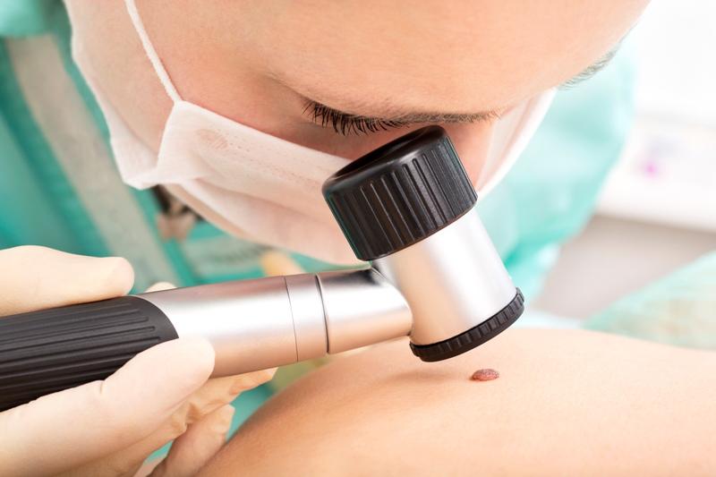 Global Melanoma Therapeutics Market