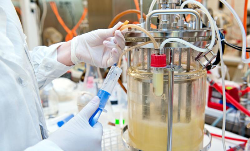 Microbial Fermentation Technology Market