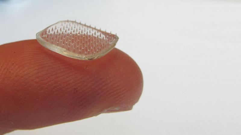 Microneedle Drug Delivery Systems