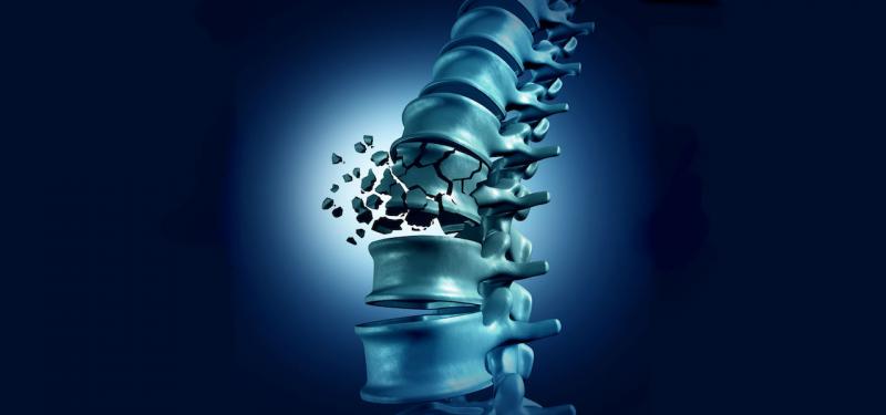 Minimally Invasive Vertebral Compression Fracture Treatments 