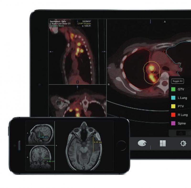 Mobile Medical Imaging Services