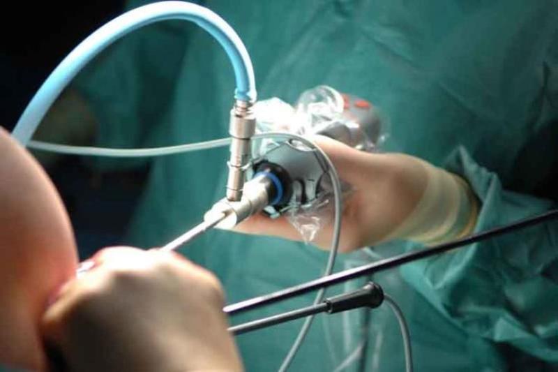 Myomectomy