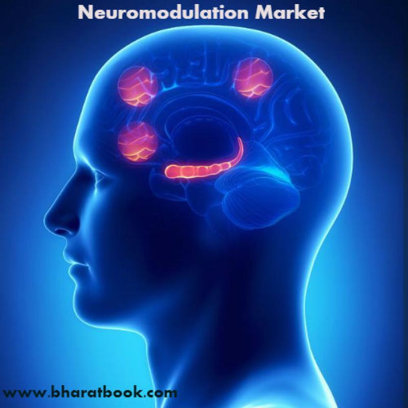 Global Neuromodulation Market : Analysis & Forecast 2021