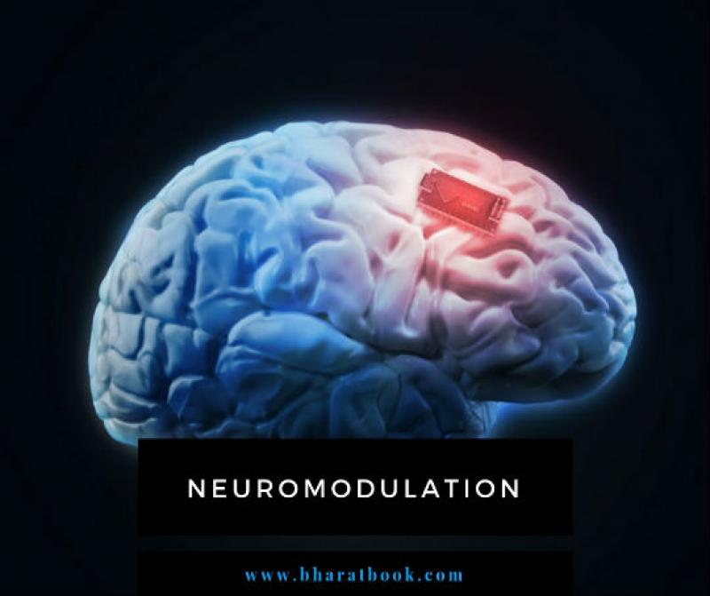 Global Neuromodulation Market Research Report 2018