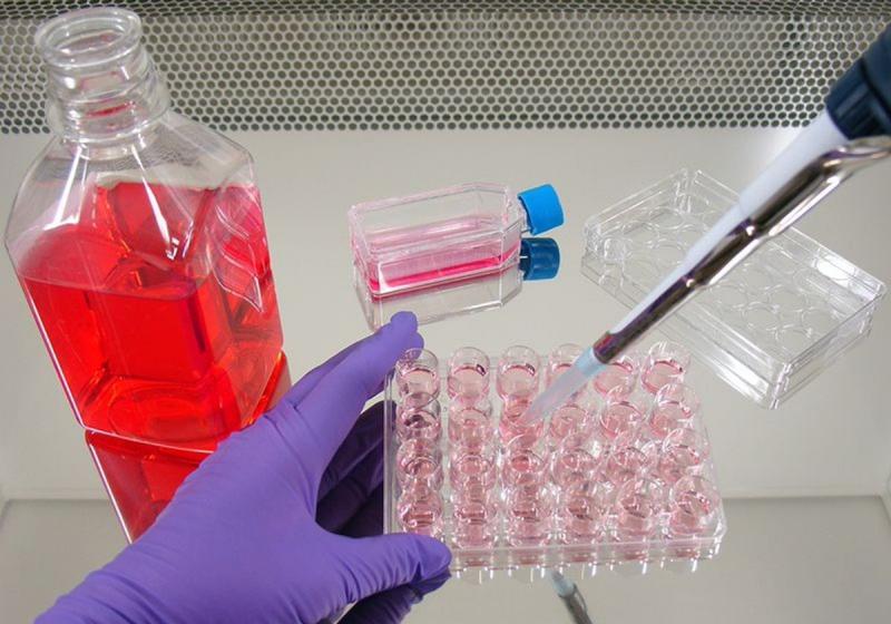 Newborn Calf Serum Market