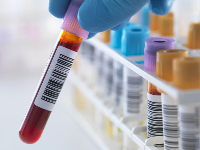 Nucleic Acid Testing (NAT) Analyzers and Reagents