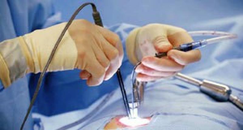 Obesity Surgery Devices