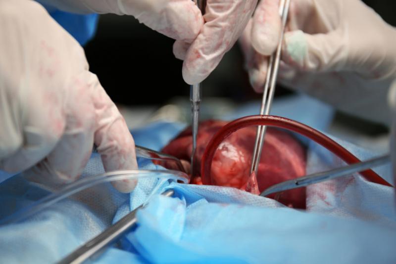 Organ Transplantation Immunosuppressive Drug market