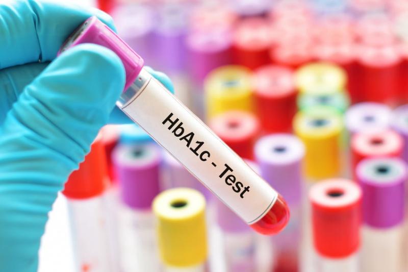  POC HbA1C Testing Market